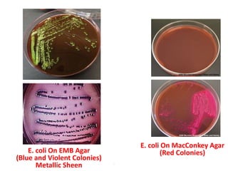 E. coli On MacConkey Agar
(Red Colonies)
.
E. coli On EMB Agar
(Blue and Violent Colonies)
Metallic Sheen
 