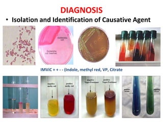 IMViC + + - - (Indole, methyl red, VP, Citrate
• Isolation and Identification of Causative Agent
DIAGNOSIS
 