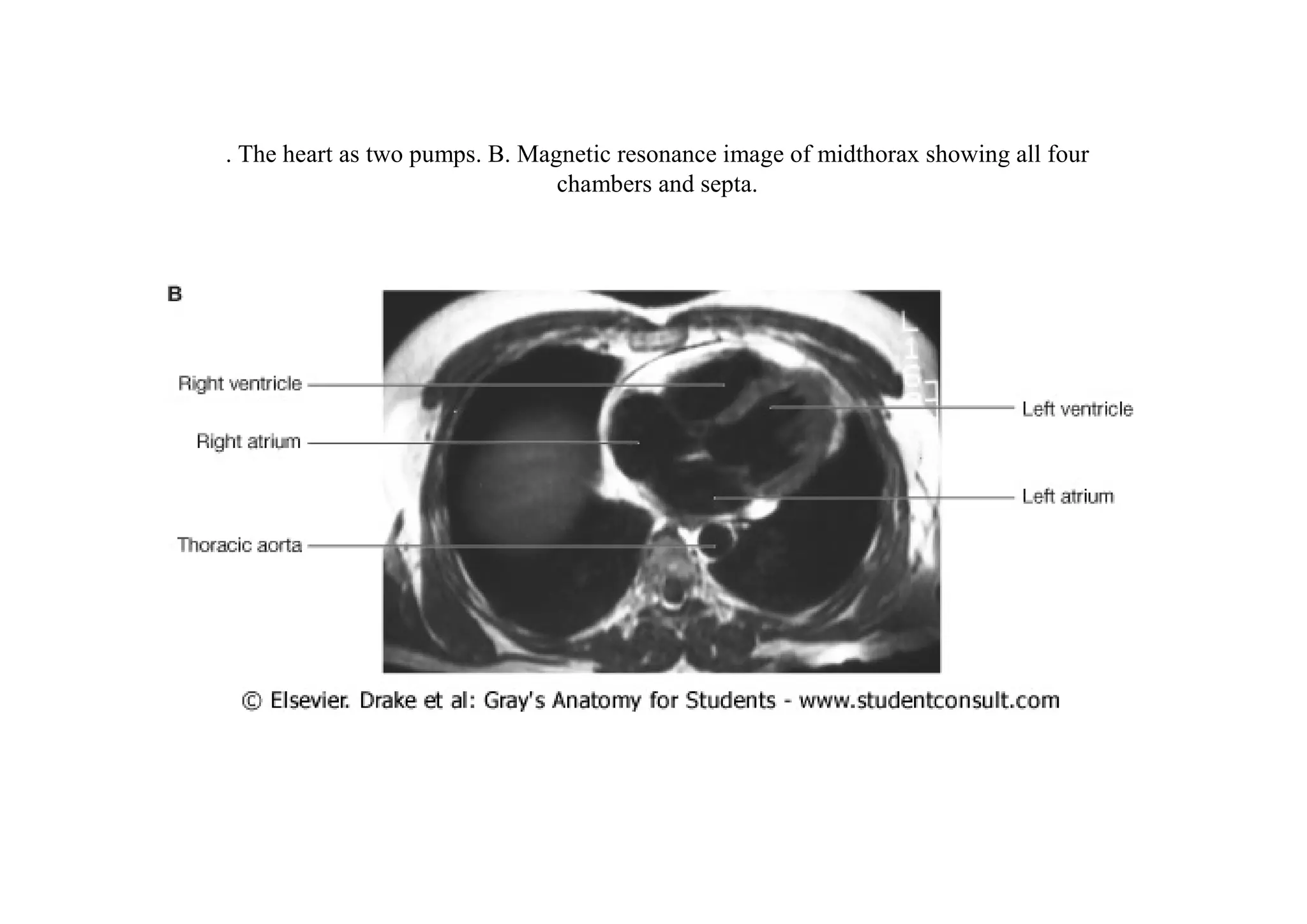 . The heart as two pumps. B. Magnetic resonance image of midthorax showing all four
                                chambers and septa.
 