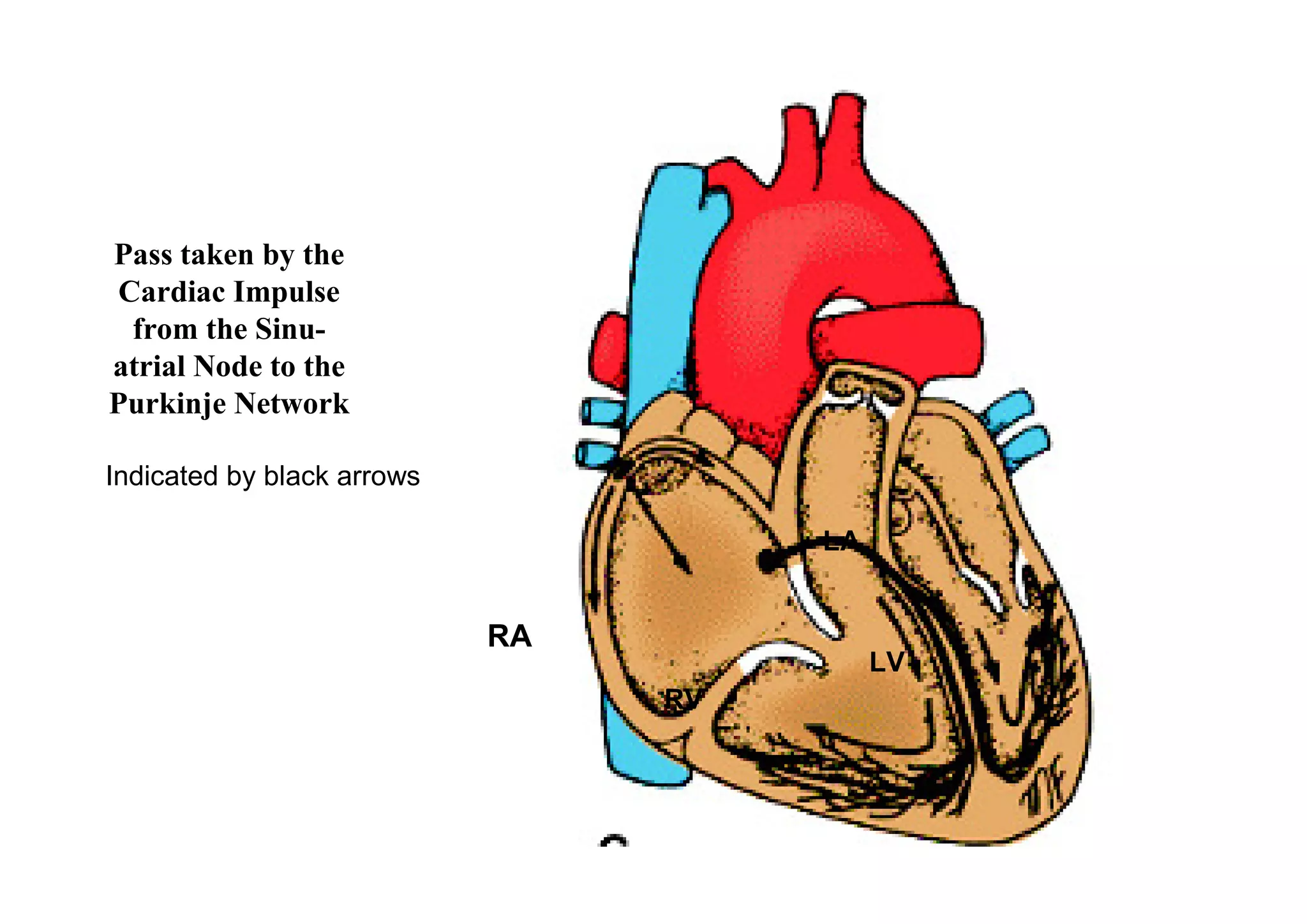 Pass taken by the
Cardiac Impulse
 from the Sinu-
atrial Node to the
Purkinje Network

Indicated by black arrows

                                      LA


                            RA
                                           LV
                                 RV
 