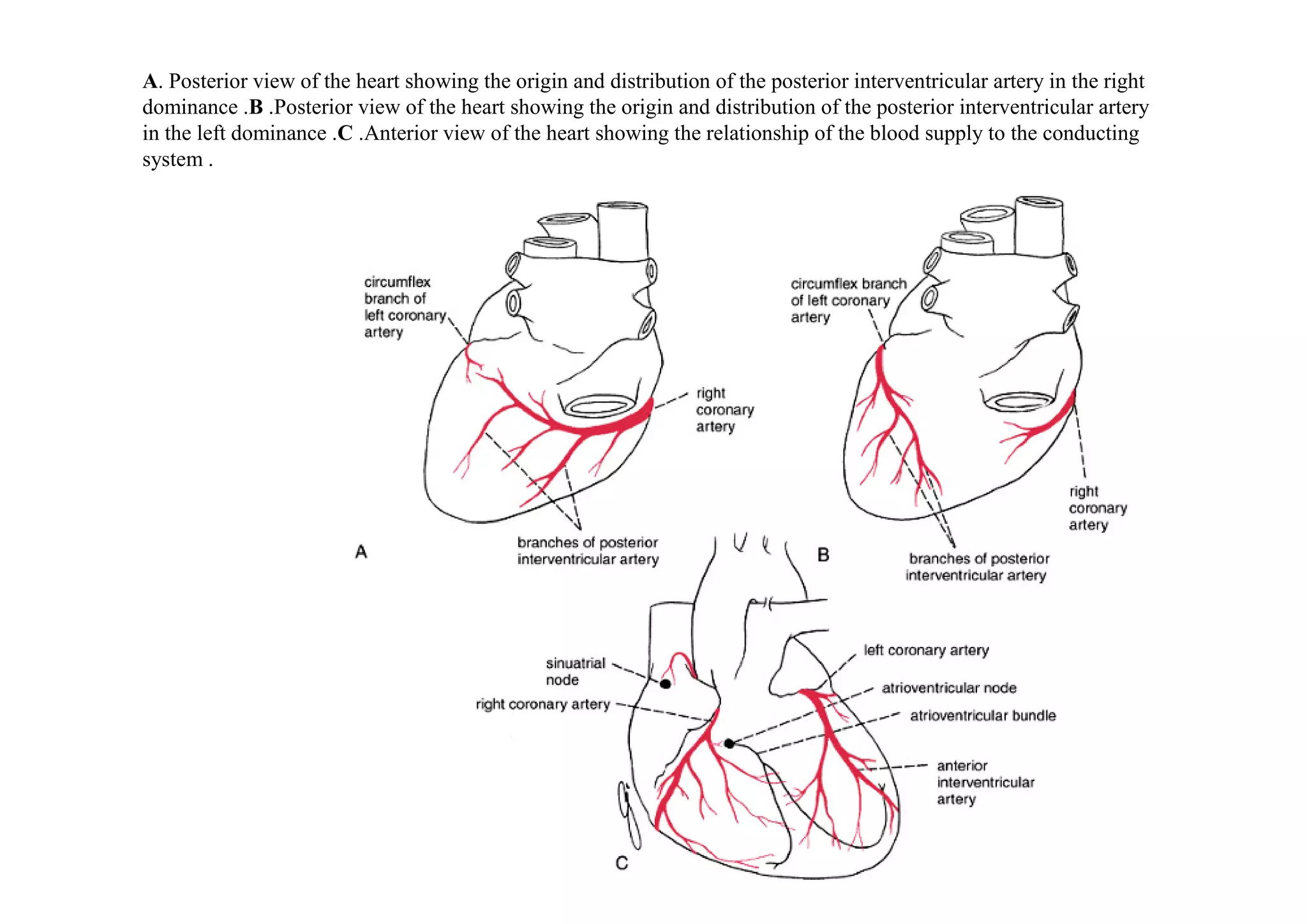 A. Posterior view of the heart showing the origin and distribution of the posterior interventricular artery in the right
dominance .B .Posterior view of the heart showing the origin and distribution of the posterior interventricular artery
in the left dominance .C .Anterior view of the heart showing the relationship of the blood supply to the conducting
system .
 