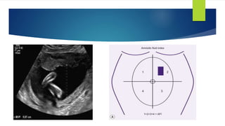 Lecture 4 Role of ultrasound in obstetrics | PPTX