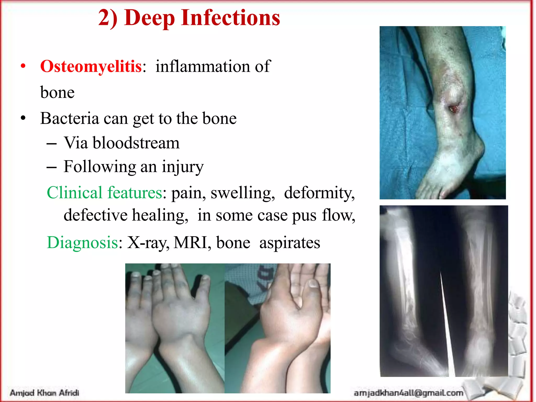 Staphylococcus | PPT