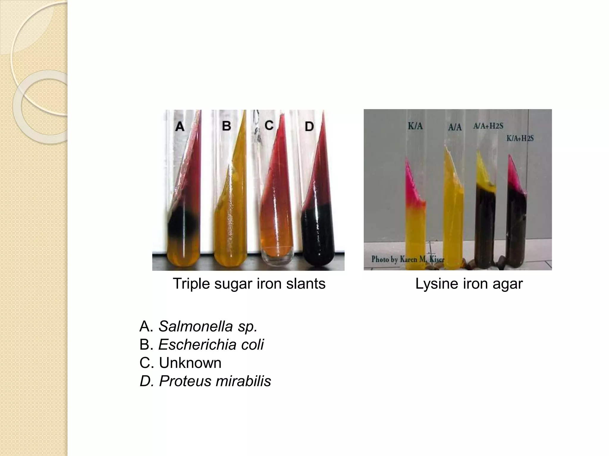 Triple sugar iron slants Lysine iron agar
A. Salmonella sp.
B. Escherichia coli
C. Unknown
D. Proteus mirabilis
 