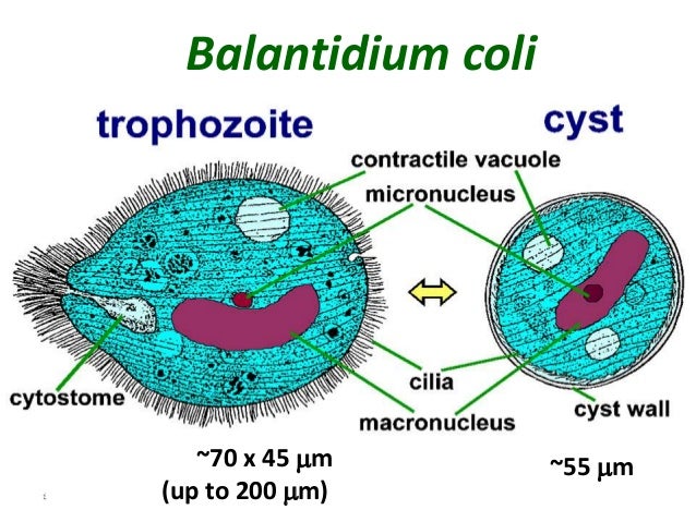 Balantidium coli