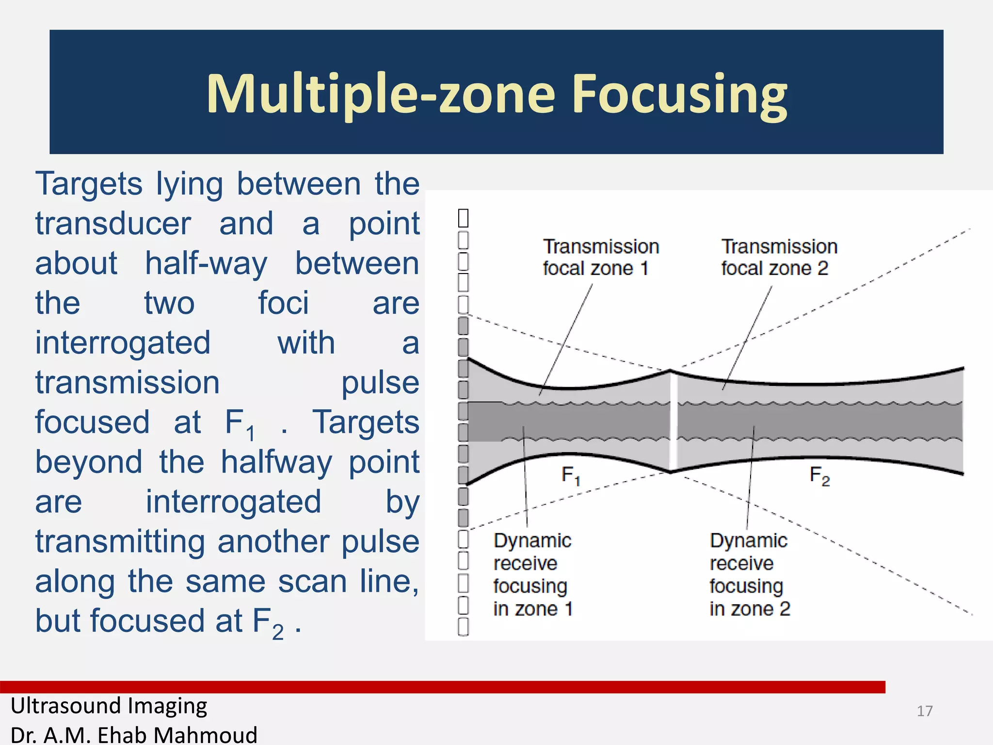 Medical Equipment Ultrasound Lecture 5 | PDF