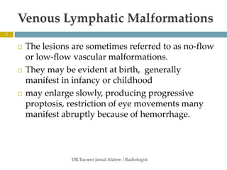 orbital vascular lesions 2