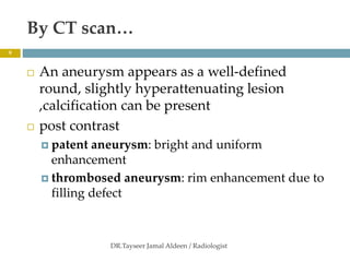 orbital vascular lesions 2