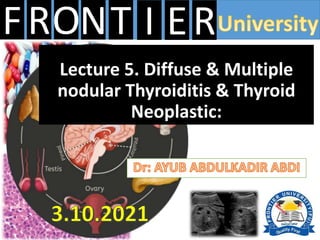 FRONT E
I R
Lecture 5. Diffuse & Multiple
nodular Thyroiditis & Thyroid
Neoplastic:
 