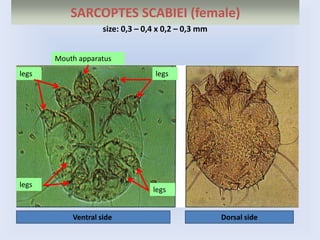 SARCOPTES SCABIEI (female)
Ventral side Dorsal side
size: 0,3 – 0,4 х 0,2 – 0,3 mm
legs legs
legs
legs
Mouth apparatus
 