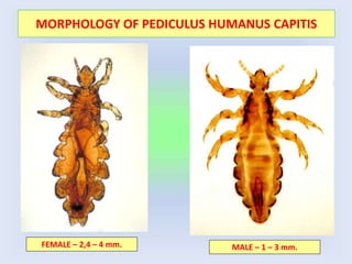 MORPHOLOGY OF PEDICULUS HUMANUS CAPITIS
FEMALE – 2,4 – 4 mm. MALE – 1 – 3 mm.
 