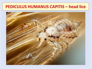 PEDICULUS HUMANUS CAPITIS – head lice
 