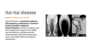 Itai-itai disease
Itai-itai disease is caused by cadmium
(Cd) exposure, produced as a result of
human activities related to
industrialisation, and this condition was
first recognised in Japan in the 1960s.
Itai-itai disease is characterised by
osteomalaecia with severe bone pain
and is associated with renal tubular
dysfunction.
 