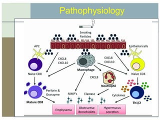 Lecture 5 asthma and copd | PPT