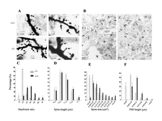 Lecture 5   learning & memory