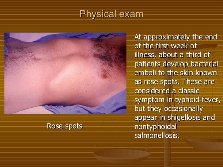 Lecture 5. typhoid fever 3