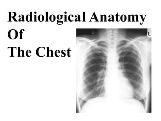 Radiological Anatomy
Of
The Chest
 