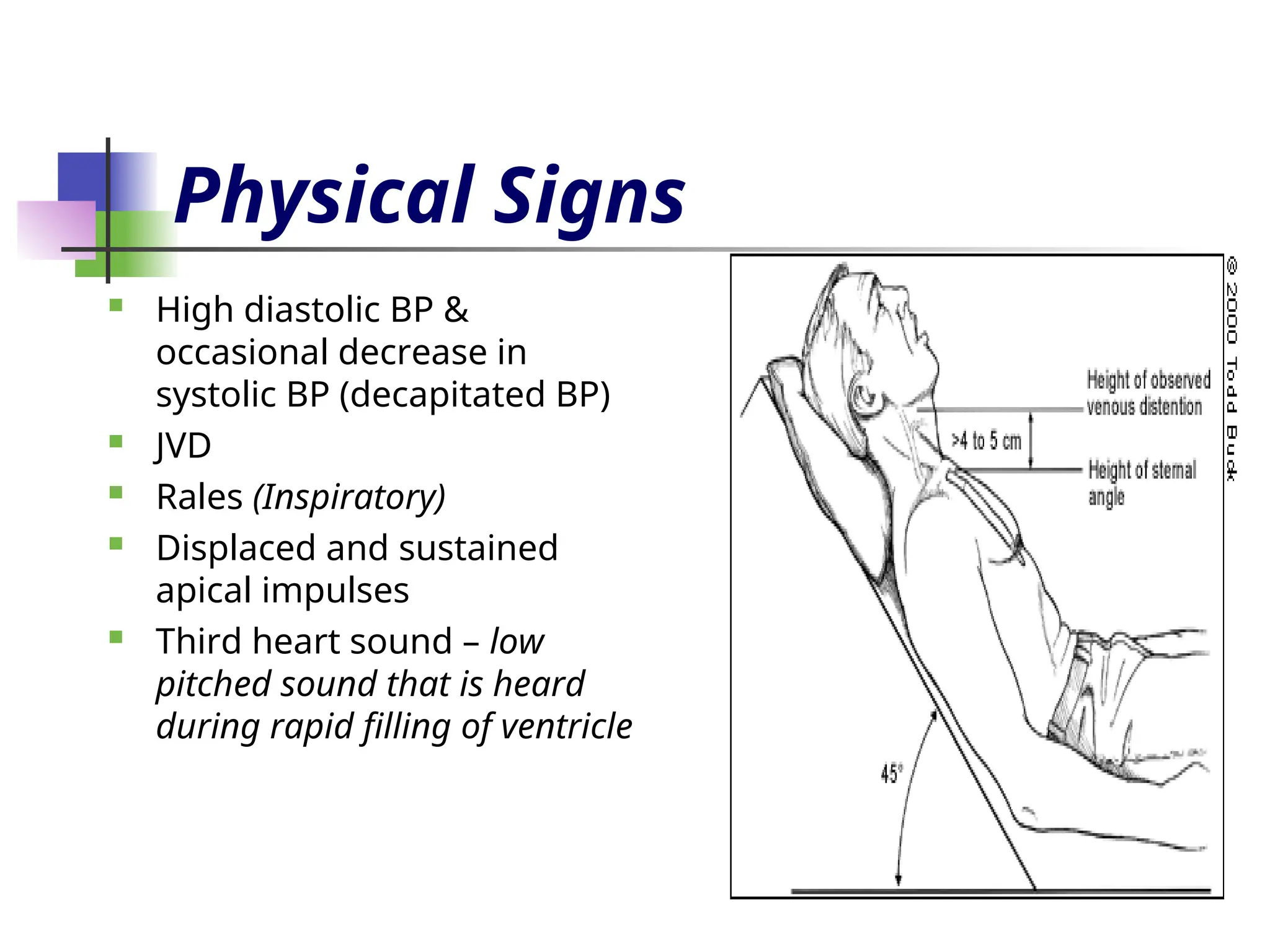 Physical Signs
 High diastolic BP &
occasional decrease in
systolic BP (decapitated BP)
 JVD
 Rales (Inspiratory)
 Displaced and sustained
apical impulses
 Third heart sound – low
pitched sound that is heard
during rapid filling of ventricle
 