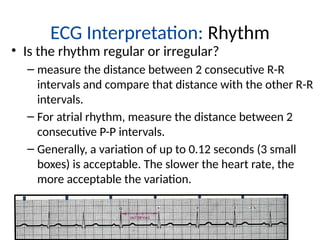 Two Consecutive R Waves Lecture 5 Ecg lecture ECG Lecture Educational.pptx