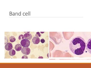 Granulocytes include neutrophils, eosinophils, and basophils | PPTX