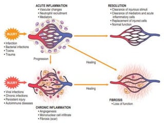 Inflamm LECTURE 5 INFLAMMATION.pptx