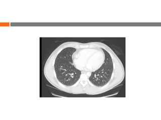 UNDERSTANDING CT SCAN windowing | PPTX