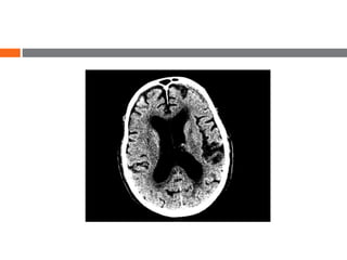 Window Ct Cs UNDERSTANDING CT SCAN windowing | PPTX