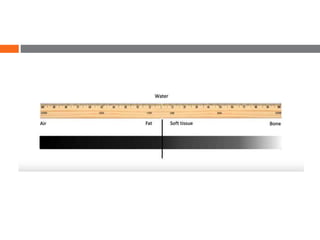 Windowing Image UNDERSTANDING CT SCAN windowing | PPTX