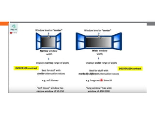 UNDERSTANDING CT SCAN windowing | PPTX