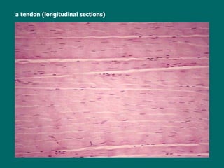   a tendon (longitudinal sections) 
