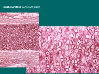 Elastic  cartilage  stained with  orcein   