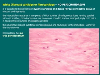 White (fibrous) cartilage or fibrocartilage  – NO PERICHONDRIUM is a transitional t issue  between  hyaline cartilage and dense fibrous connective tissue  of tendons and ligaments the  intercellular substance is composed of thick bundles of collagenous fibers running parallel with one another ,   c hondrocytes are not numerous, rounded and are arranged singly or in pairs in rows between bundles of collagenous fibers  t he amorphous ground substance is inconspicuous  and  found only in the immediate  vicinity of the chondrocytes f ibrocartilage has  no true perichondrium 