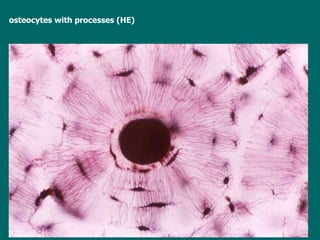 osteocytes with processes (HE) 
