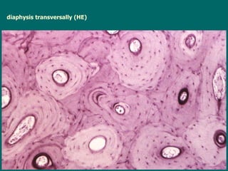 diaphysis transversally (HE) 
