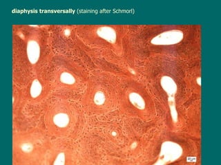 diaphysis transversally  (staining after Schmorl) 