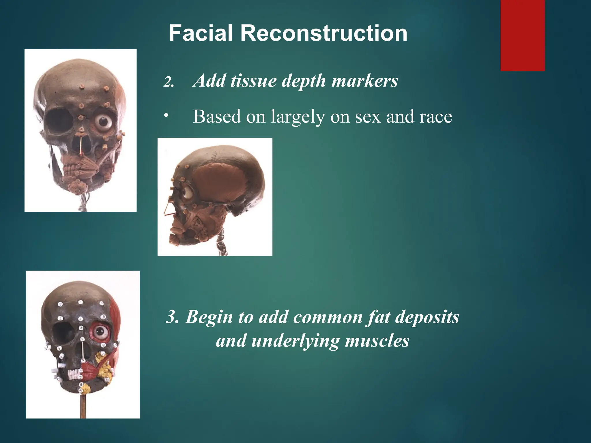 Facial Reconstruction
2. Add tissue depth markers
• Based on largely on sex and race
3. Begin to add common fat deposits
and underlying muscles
 