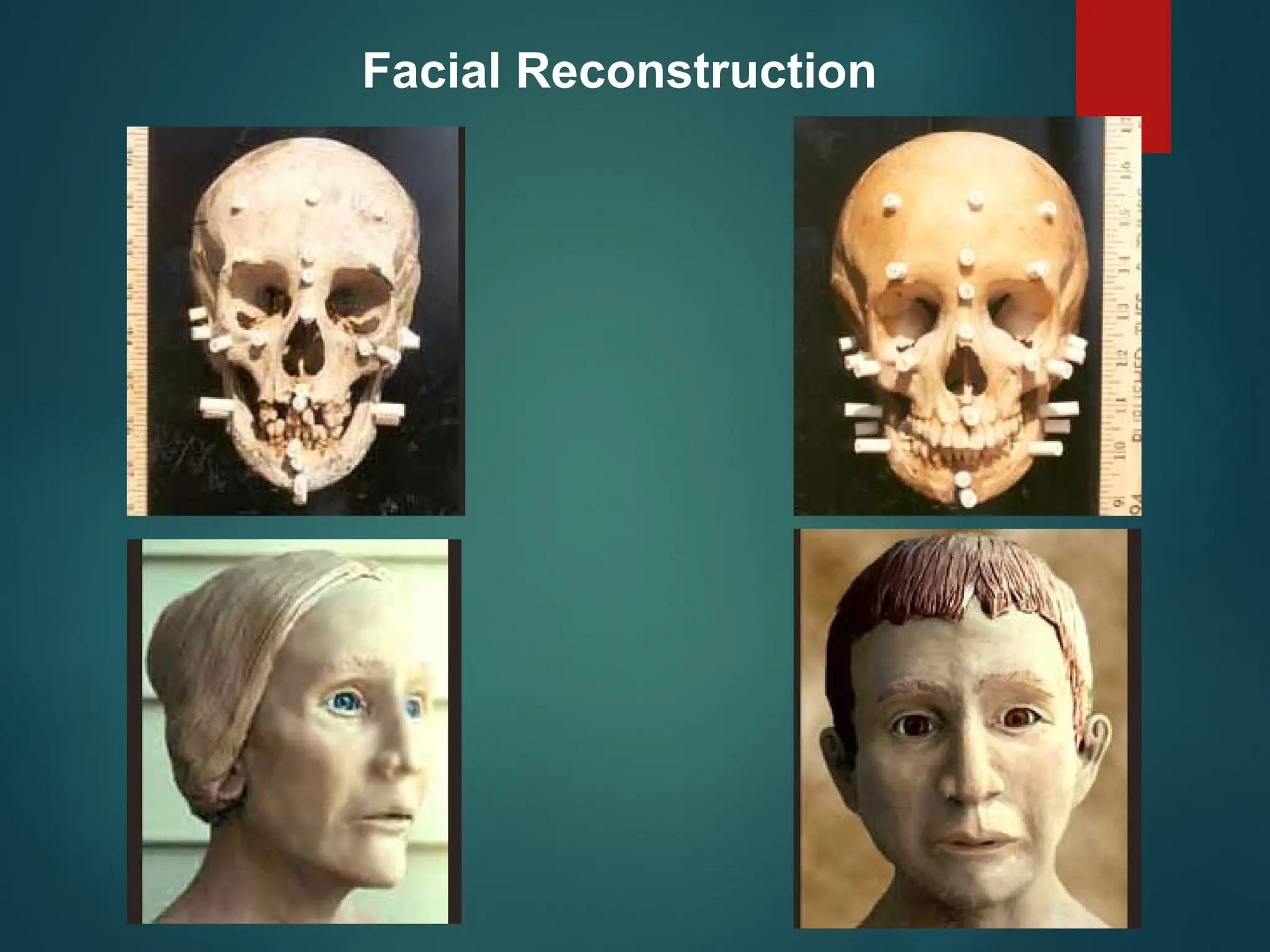 Facial Reconstruction
 