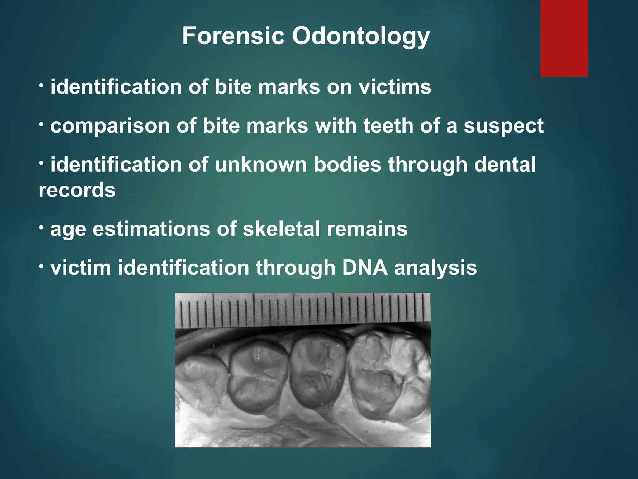 Forensic Odontology
• identification of bite marks on victims
• comparison of bite marks with teeth of a suspect
• identification of unknown bodies through dental
records
• age estimations of skeletal remains
• victim identification through DNA analysis
 
