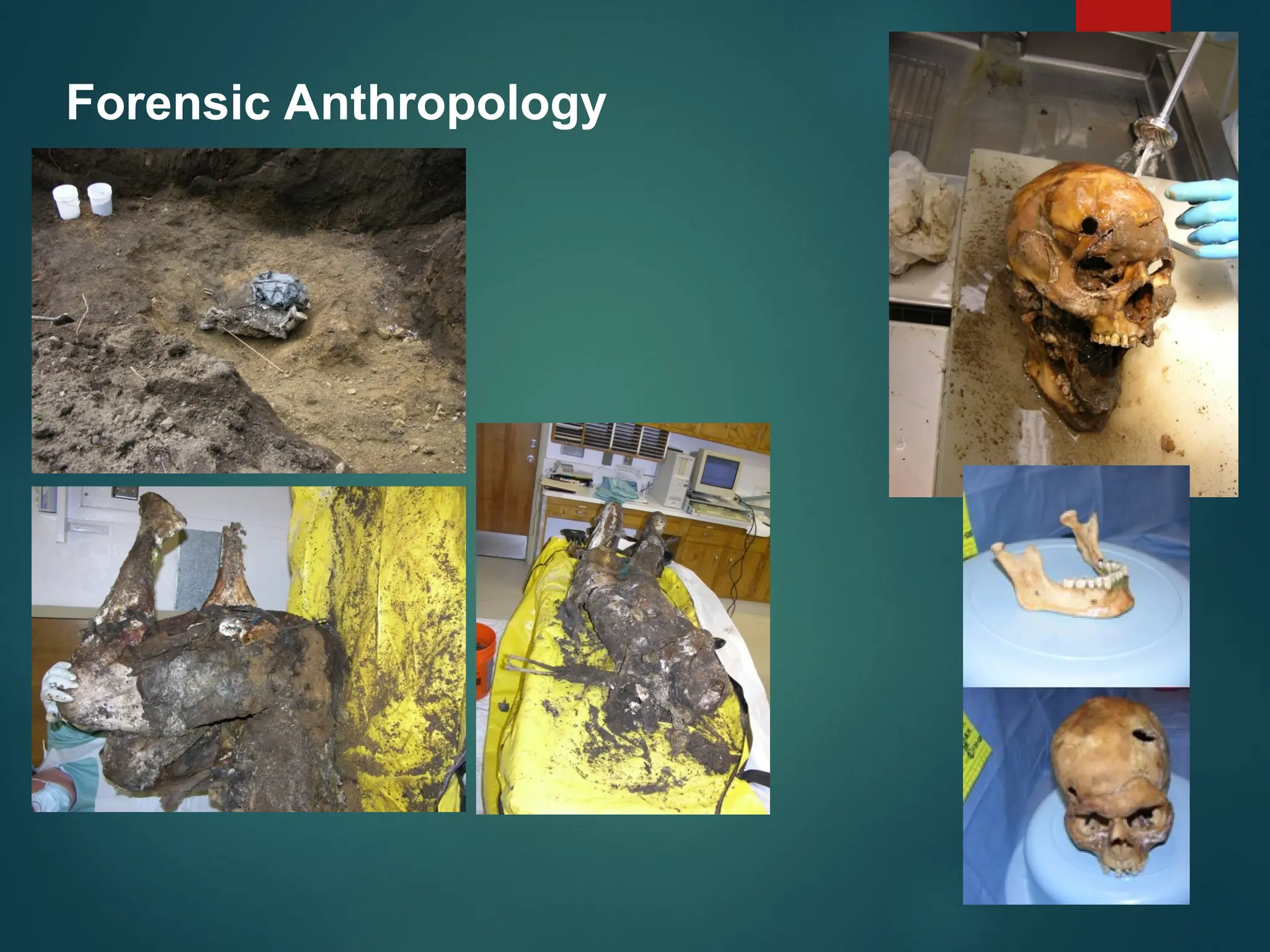 Forensic Anthropology
 