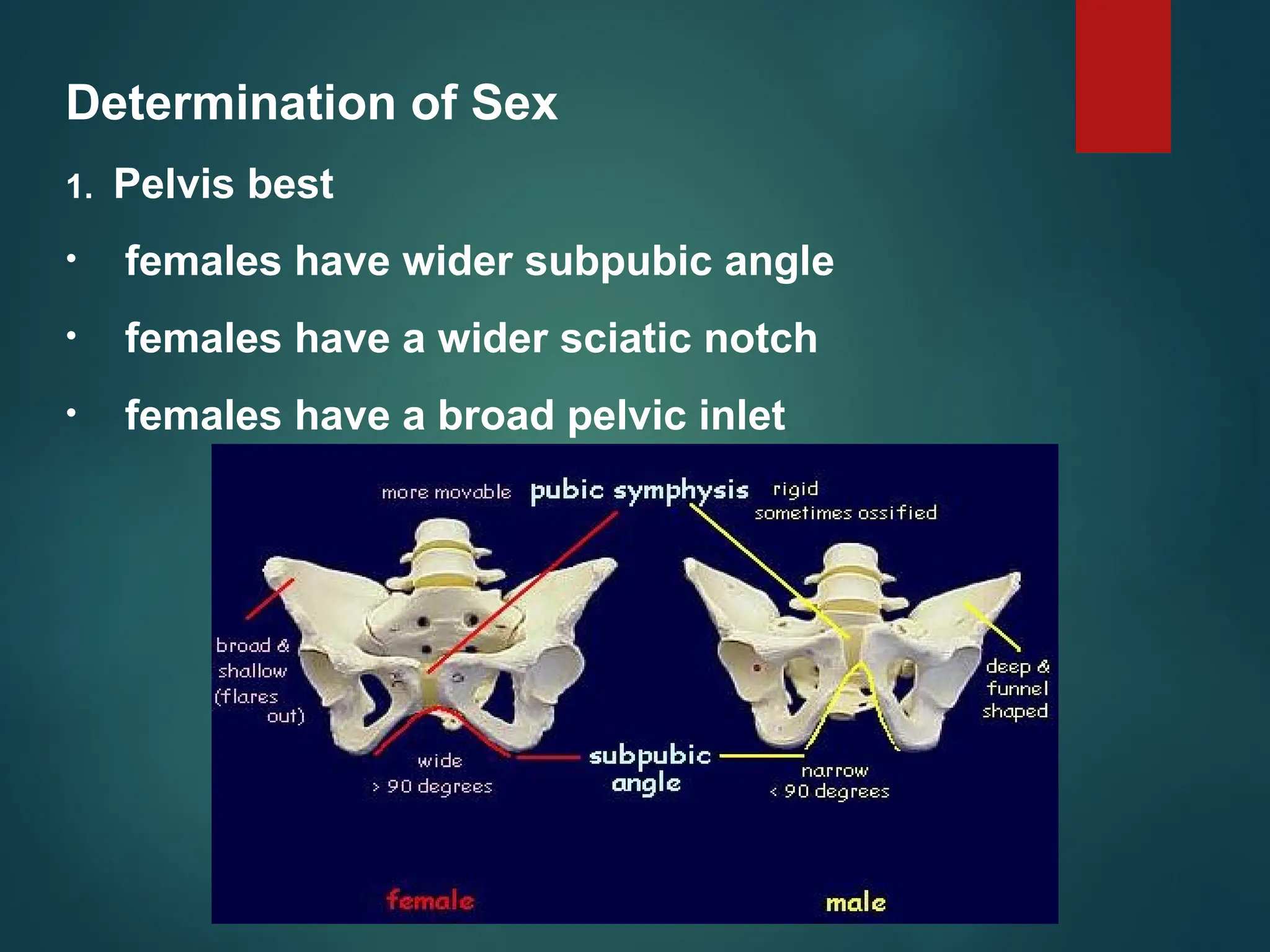 Determination of Sex
1. Pelvis best
• females have wider subpubic angle
• females have a wider sciatic notch
• females have a broad pelvic inlet
 