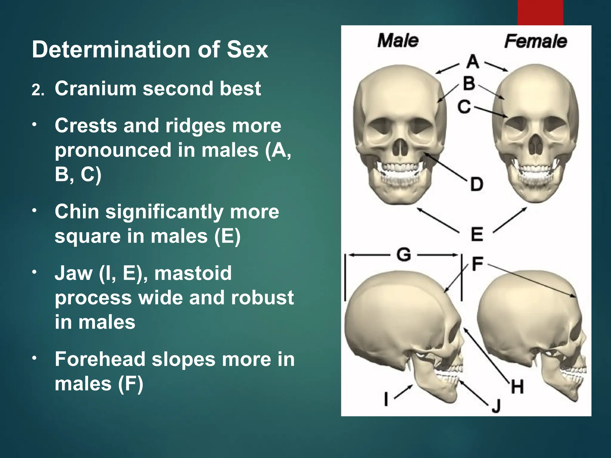 Determination of Sex
2. Cranium second best
• Crests and ridges more
pronounced in males (A,
B, C)
• Chin significantly more
square in males (E)
• Jaw (I, E), mastoid
process wide and robust
in males
• Forehead slopes more in
males (F)
 
