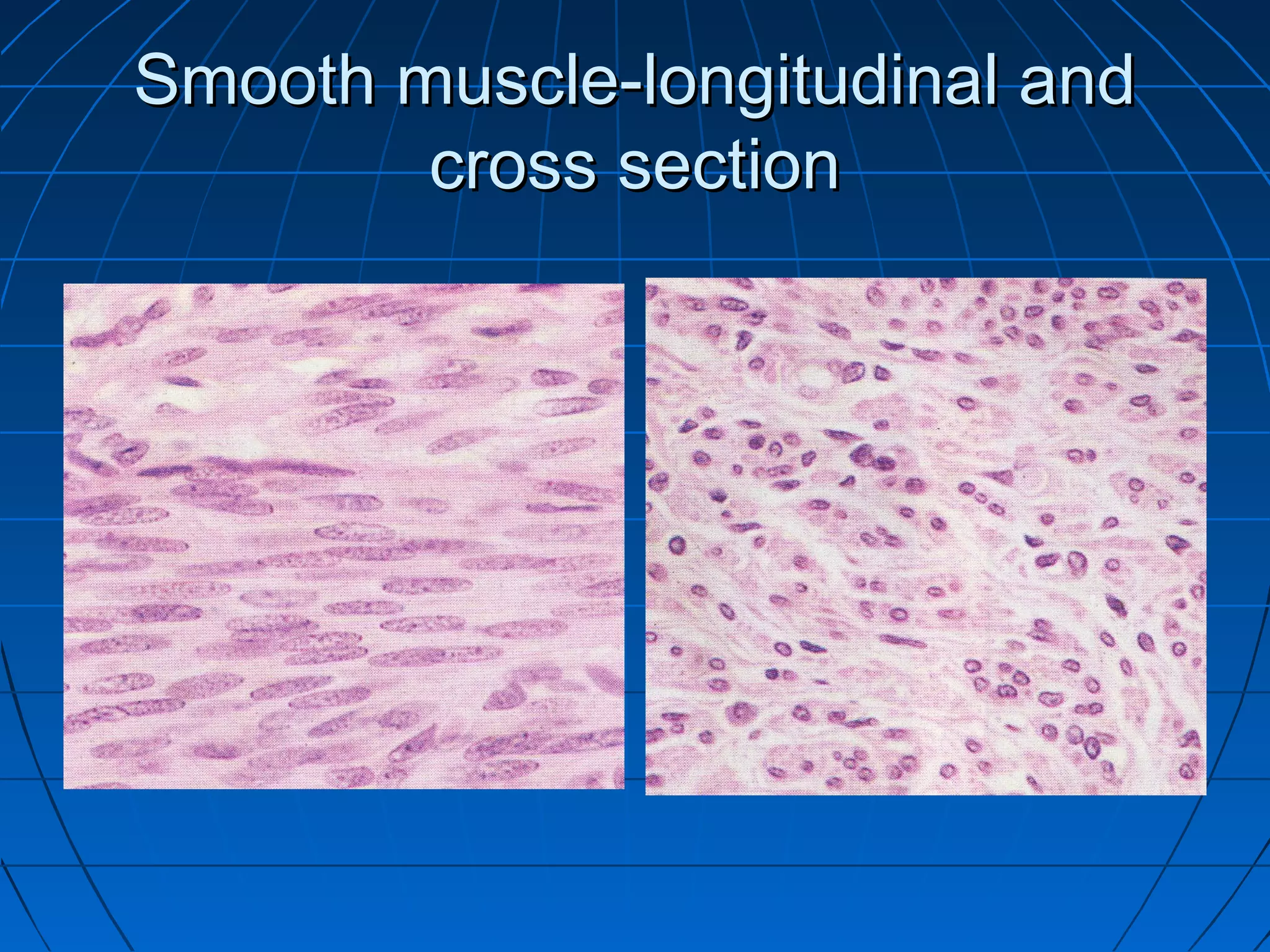 Smooth muscle-longitudinal and
cross section

 