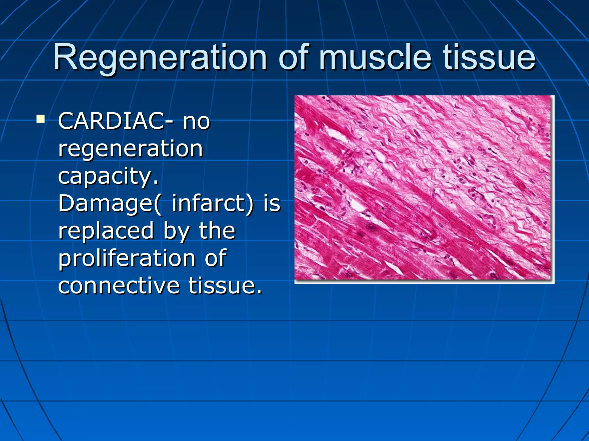 Regeneration of muscle tissue


CARDIAC- no
regeneration
capacity.
Damage( infarct) is
replaced by the
proliferation of
connective tissue.

 