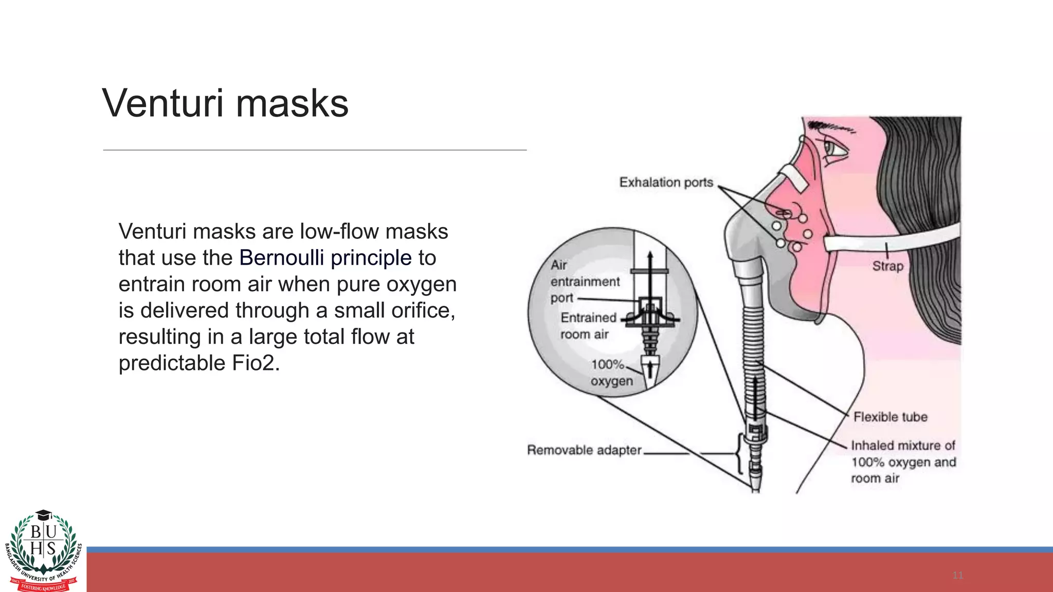 Venturi masks
11
Venturi masks are low-flow masks
that use the Bernoulli principle to
entrain room air when pure oxygen
is delivered through a small orifice,
resulting in a large total flow at
predictable Fio2.
 