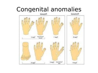 Congenital anomalies
radial club hand - Shortcut.lnk
radial club hand - Shortcut.lnk
 