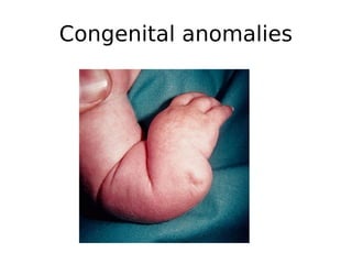 Congenital anomalies
 