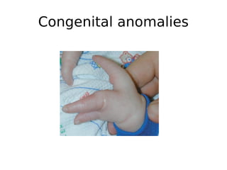 Congenital anomalies
 