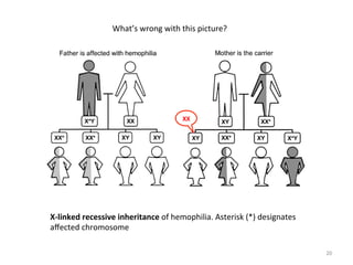 20 
What’s 
wrong 
with 
this 
picture? 
X-­‐linked 
recessive 
inheritance 
of 
hemophilia. 
Asterisk 
(*) 
designates 
affected 
chromosome 
XX 
 