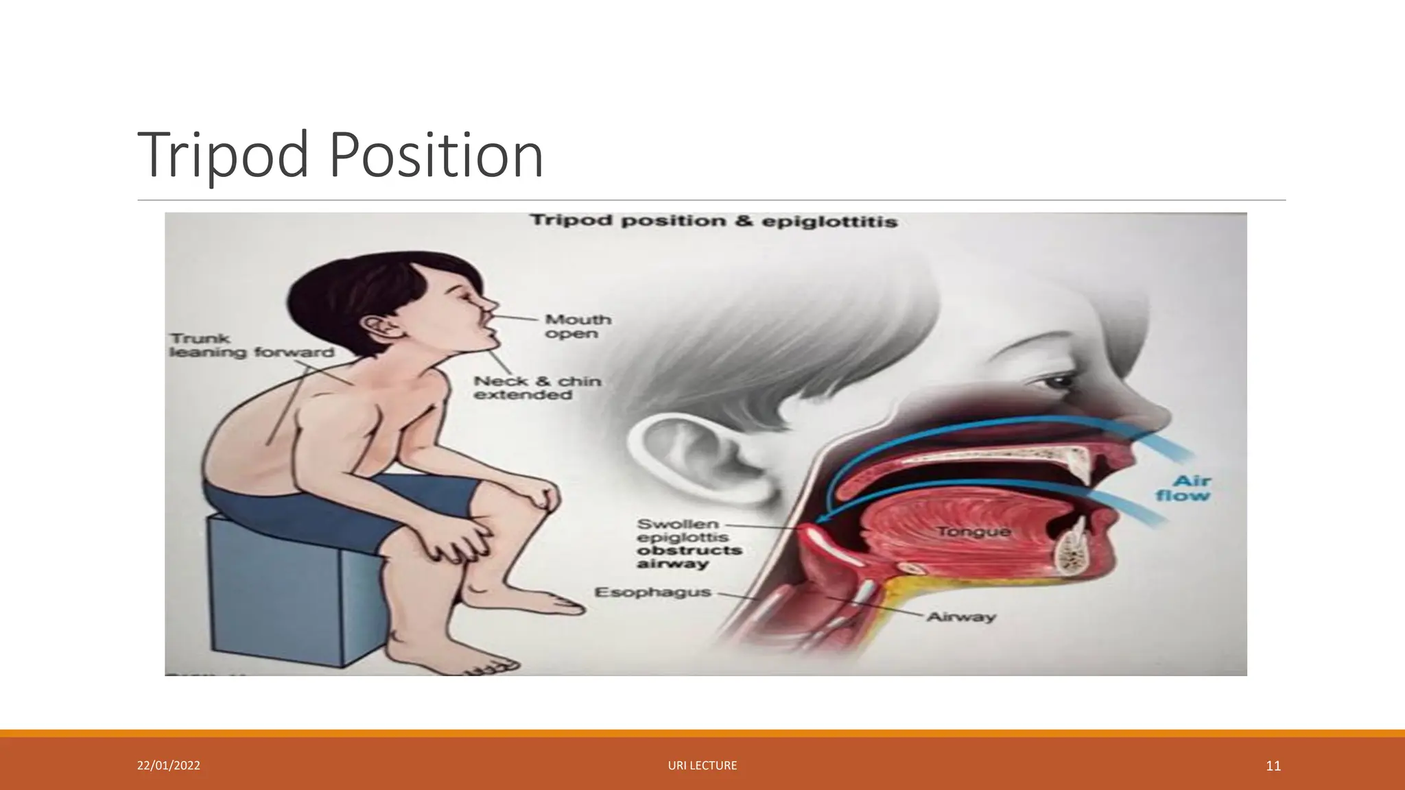 Tripod Position
22/01/2022 URI LECTURE 11
 