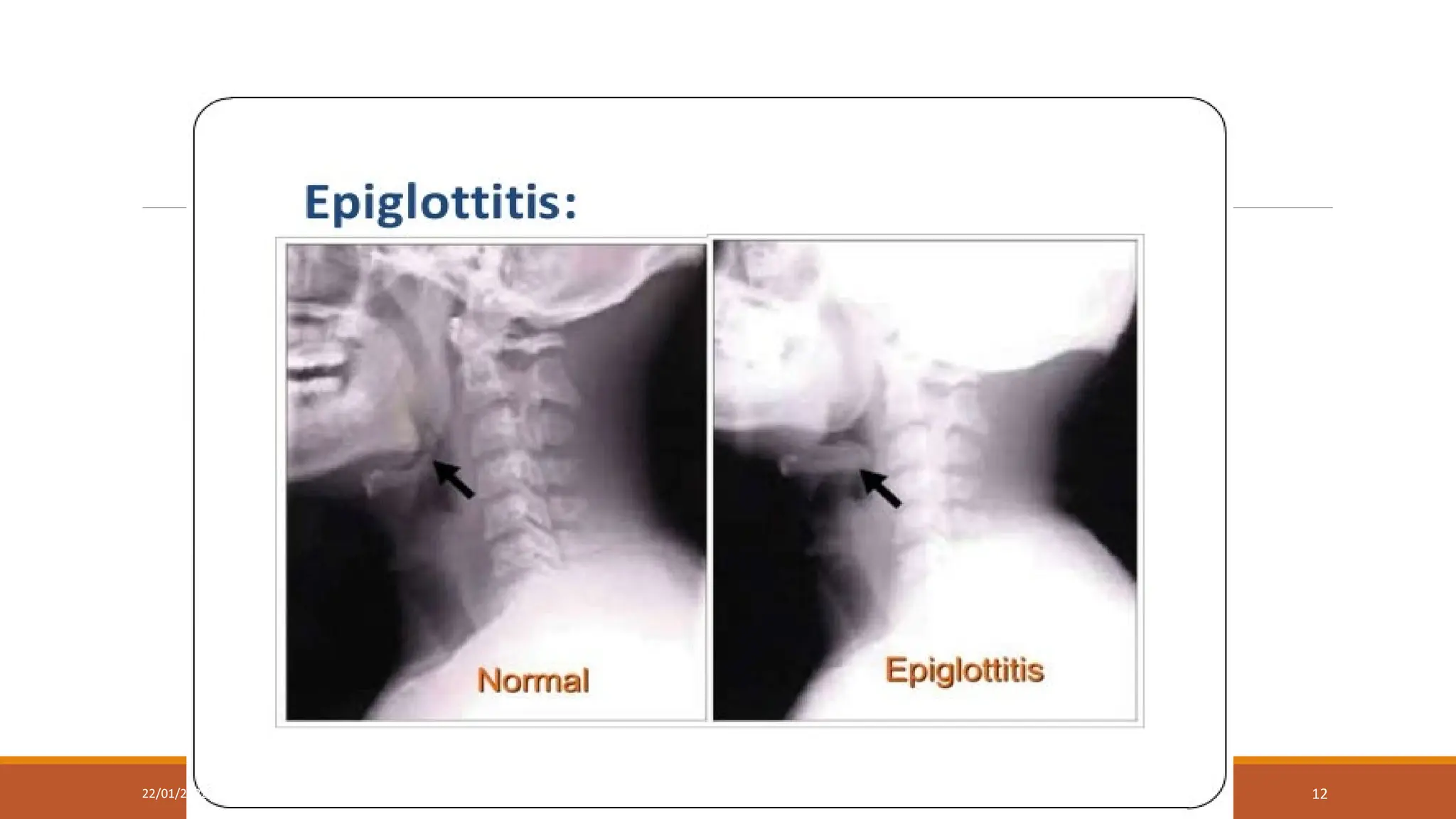 22/01/2022 URI LECTURE 12
 